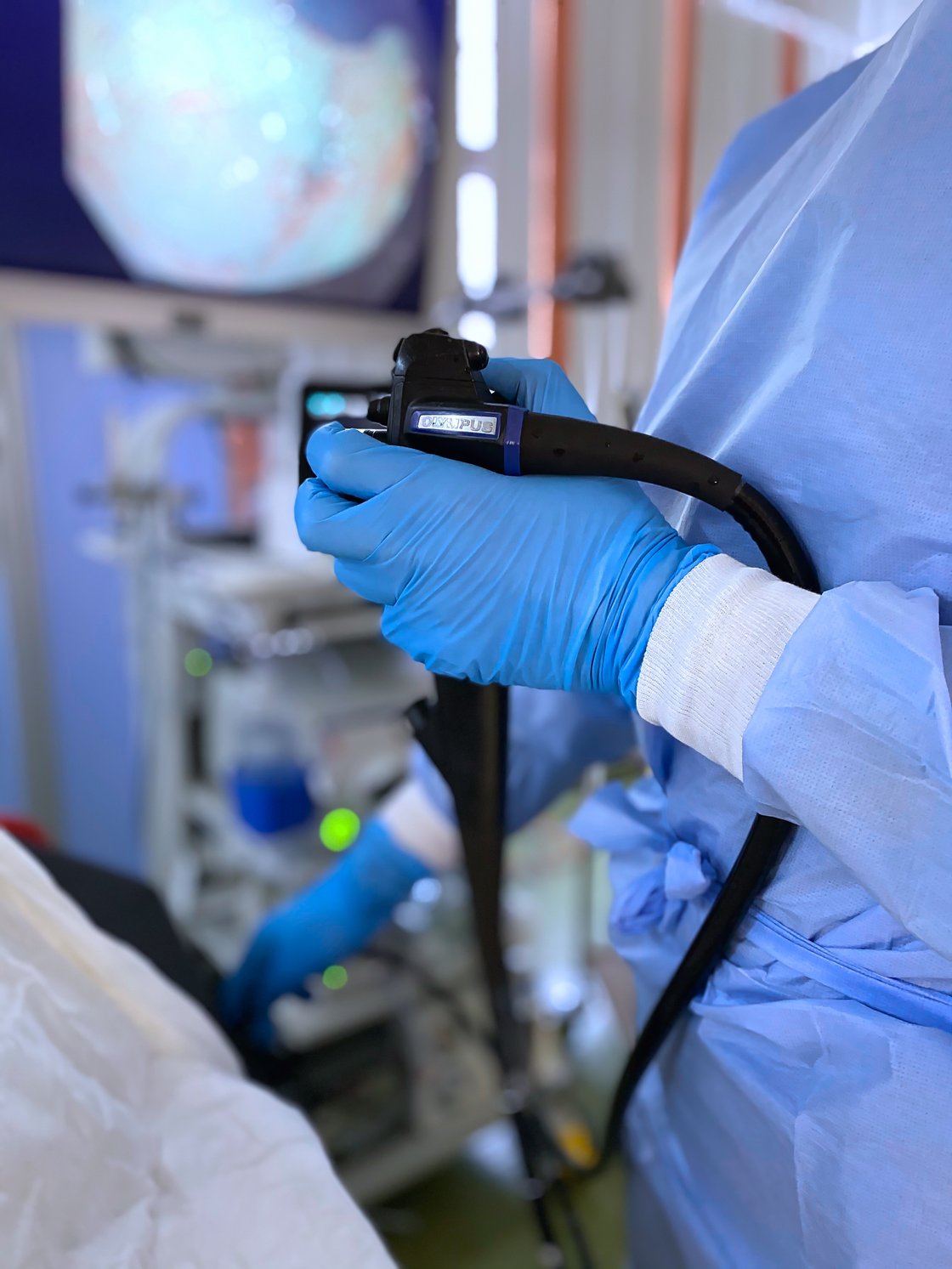 Quelle: Uniklinik Ulm Endoskop